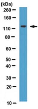 Anti-hRNF20 Antibody from rabbit, purified by affinity chromatography