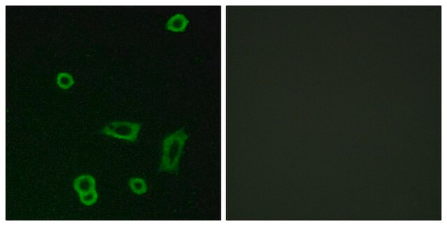 Anti-MTR1L antibody produced in rabbit affinity isolated antibody