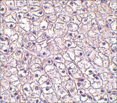 Anti-TSLP Receptor (ab1) antibody produced in rabbit affinity isolated antibody, buffered aqueous solution