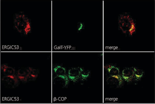 抗ERGIC-53/p58 兔抗 affinity isolated antibody, buffered aqueous solution