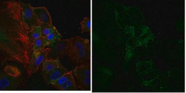 Anti-Surfactant Protein D Antibody, Alexa Fluor&#8482; 488 Conjugate from rabbit, ALEXA FLUOR&#8482; 488