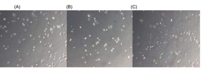 Normal Human Hepatic Kupffer Cells Single-Donor Cryopreserved Kupffer cells isolated from human livers, high viability, and characterized by cell specific markers and response to LPS stimulation