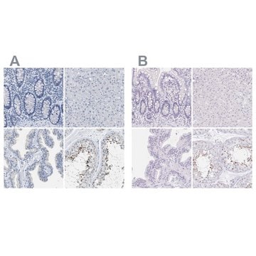 Anti-EQTN antibody produced in rabbit Prestige Antibodies&#174; Powered by Atlas Antibodies, affinity isolated antibody, buffered aqueous glycerol solution