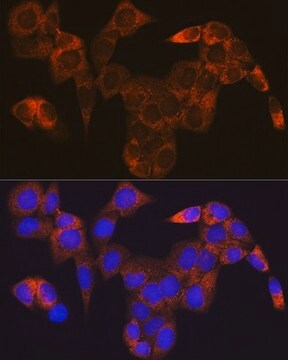 Anti-GOT1 antibody produced in rabbit