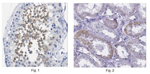 Anti-E3 ubiquitin-protein ligase UHRF2 Antibody from rabbit, purified by affinity chromatography