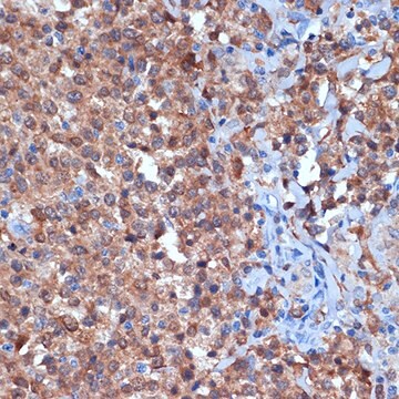 Anti-PKC delta Antibody, clone 7I5U6, Rabbit Monoclonal