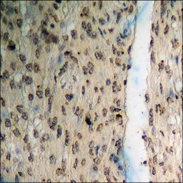 Anti-phospho-FHIT (pTyr114) antibody produced in rabbit affinity isolated antibody