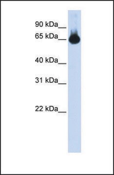 Anti-FOXG1, (N-terminal) antibody produced in rabbit affinity isolated antibody