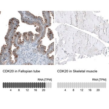 Anti-CDK20 antibody produced in rabbit Prestige Antibodies&#174; Powered by Atlas Antibodies, affinity isolated antibody, buffered aqueous glycerol solution, ab2