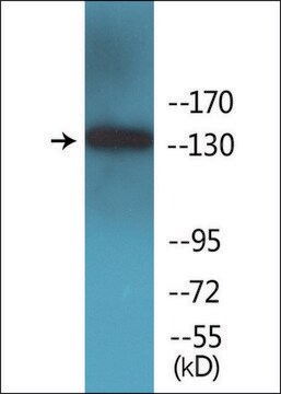 Anti-phospho-IRS-1 (pSer1101) antibody produced in rabbit affinity isolated antibody