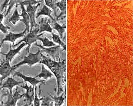 Porcine Aortic Smooth Muscle Cells: PAOSMC (Cryovial)