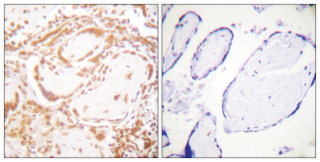 Anti-Histone H4 antibody produced in rabbit affinity isolated antibody