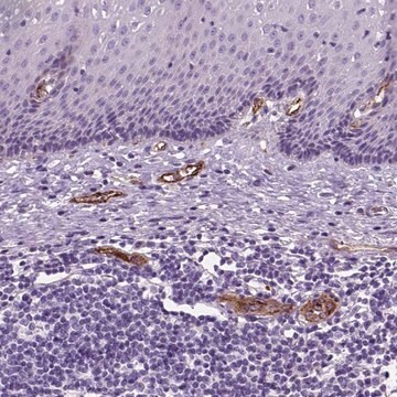 Anti-VWF antibody produced in rabbit Ab1, Prestige Antibodies&#174; Powered by Atlas Antibodies, affinity isolated antibody, buffered aqueous glycerol solution