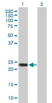 Anti-RAB39B antibody produced in rabbit purified immunoglobulin, buffered aqueous solution