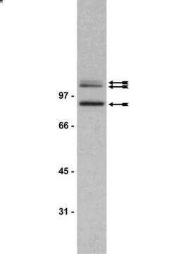 Anti-phospho-Adducin (Ser662) Antibody Upstate&#174;, from rabbit