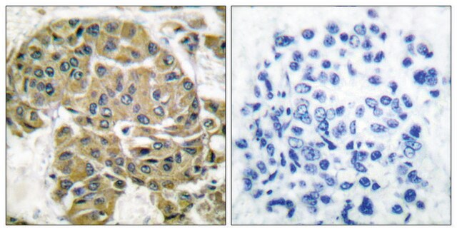 Anti-Mammaglobin B antibody produced in rabbit affinity isolated antibody