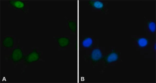 Anti-hSNF5/INI1 antibody produced in rabbit ~1&#160;mg/mL, affinity isolated antibody, buffered aqueous solution