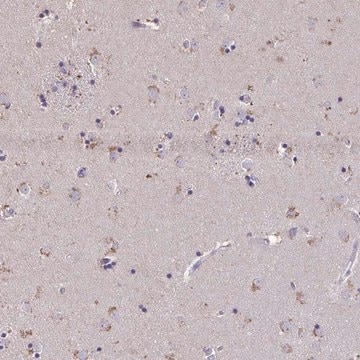 Anti-ZNF34 antibody produced in rabbit Prestige Antibodies&#174; Powered by Atlas Antibodies, affinity isolated antibody, buffered aqueous glycerol solution