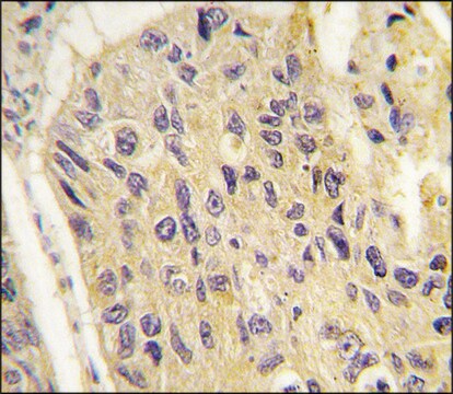 Anti-FRAT1 (C-term) antibody produced in rabbit saturated ammonium sulfate (SAS) precipitated, buffered aqueous solution