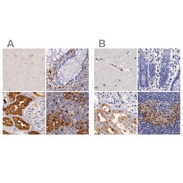 Anti-RENBP antibody produced in rabbit Ab2, Prestige Antibodies&#174; Powered by Atlas Antibodies, affinity isolated antibody, buffered aqueous glycerol solution