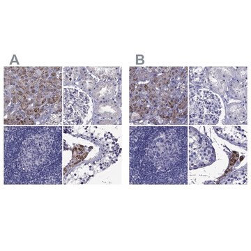 Anti-STAR antibody produced in rabbit Prestige Antibodies&#174; Powered by Atlas Antibodies, affinity isolated antibody, buffered aqueous glycerol solution, ab1