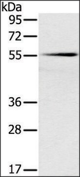 Anti-SLC16A10 antibody produced in rabbit affinity isolated antibody