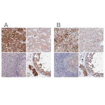 Anti-AAMDC antibody produced in rabbit Prestige Antibodies&#174; Powered by Atlas Antibodies, affinity isolated antibody, buffered aqueous glycerol solution