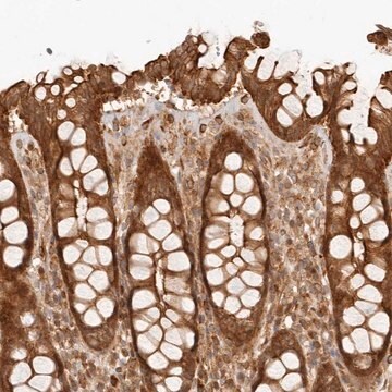 Anti-UFSP1 antibody produced in rabbit Prestige Antibodies&#174; Powered by Atlas Antibodies, affinity isolated antibody, buffered aqueous glycerol solution