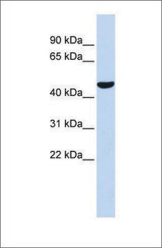 Anti-PTGIS antibody produced in rabbit affinity isolated antibody