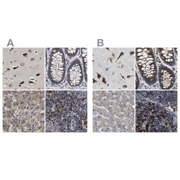 Anti-EBAG9 antibody produced in rabbit Prestige Antibodies&#174; Powered by Atlas Antibodies, affinity isolated antibody, buffered aqueous glycerol solution, Ab1