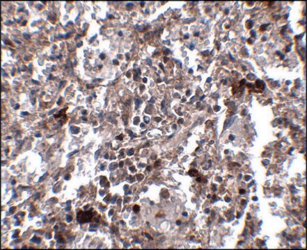 Anti-KCTD15 antibody produced in rabbit affinity isolated antibody, buffered aqueous solution