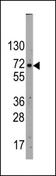 ANTI-GLUT2 (SLC2A2) (N-TERM) antibody produced in rabbit IgG fraction of antiserum, buffered aqueous solution