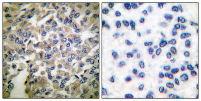 Anti-Synaptotagmin antibody produced in rabbit affinity isolated antibody