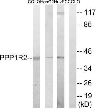 Anti-PPP1R2 antibody produced in rabbit affinity isolated antibody