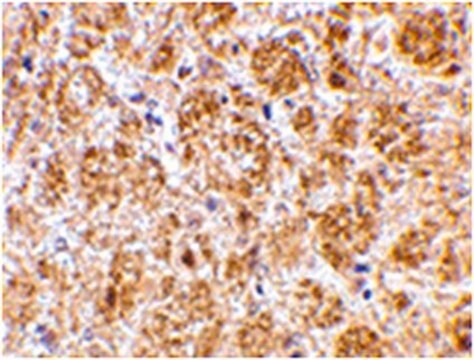 Anti-DARC Antibody from rabbit, purified by affinity chromatography