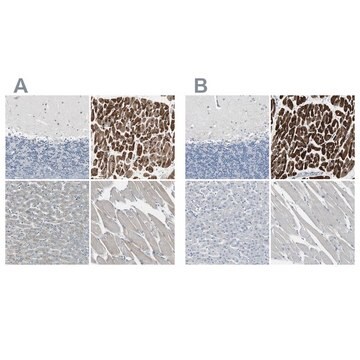 Anti-FHL2 antibody produced in rabbit Ab1, Prestige Antibodies&#174; Powered by Atlas Antibodies, affinity isolated antibody, buffered aqueous glycerol solution