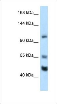 Anti-REST antibody produced in rabbit affinity isolated antibody