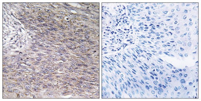 Anti-CHSY2, C-Terminal antibody produced in rabbit affinity isolated antibody