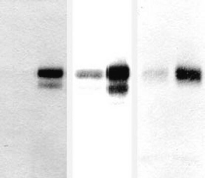 Anti-Amyloid Precursor Protein Antibody, universal serum, Chemicon&#174;