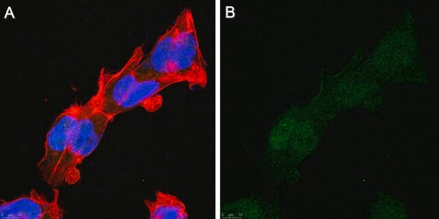 Anti-REST Antibody, clone 12C11