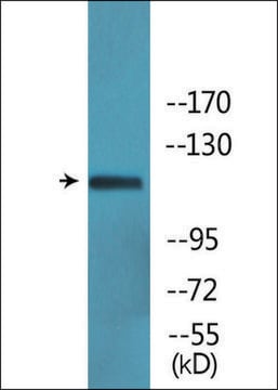 抗 磷酸化-Ret (pTyr 1062 ) 兔抗 affinity isolated antibody