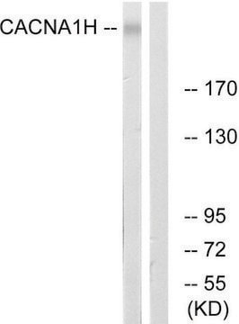 Anti-CACNA1H antibody produced in rabbit affinity isolated antibody