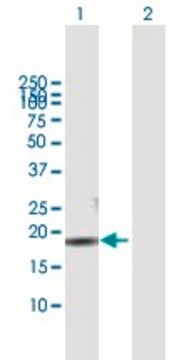 Anti-CMTM3 antibody produced in mouse purified immunoglobulin, buffered aqueous solution