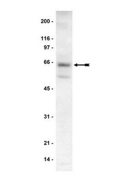 Anti-p70 S6 Kinase (S6K) Antibody Upstate&#174;, from rabbit