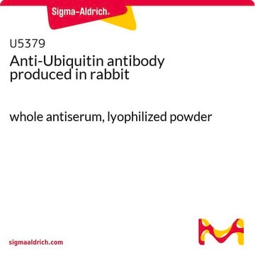 抗 泛素 兔抗 whole antiserum, lyophilized powder