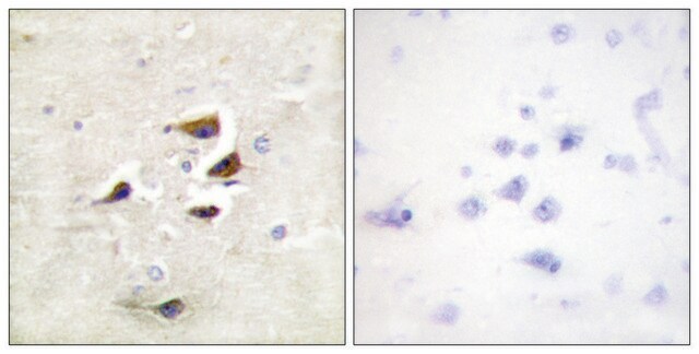 Anti-CAMK2 antibody produced in rabbit affinity isolated antibody