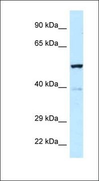 Anti-TRP63 antibody produced in rabbit affinity isolated antibody