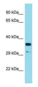 Anti-RSPO3 (C-terminal) antibody produced in rabbit affinity isolated antibody