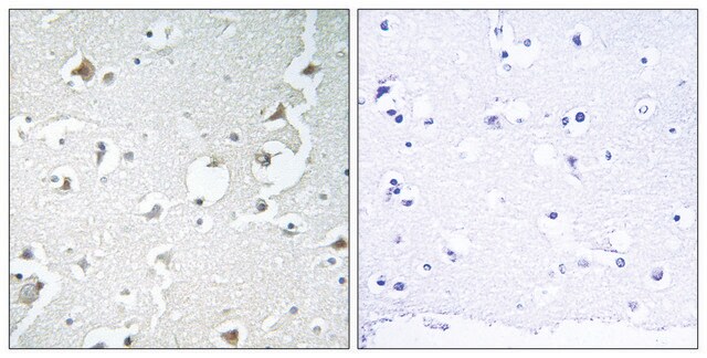 Anti-JIP1 antibody produced in rabbit affinity isolated antibody