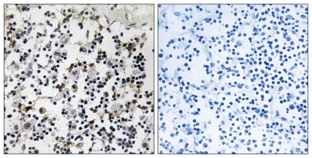 Anti-CLIC4 antibody produced in rabbit affinity isolated antibody